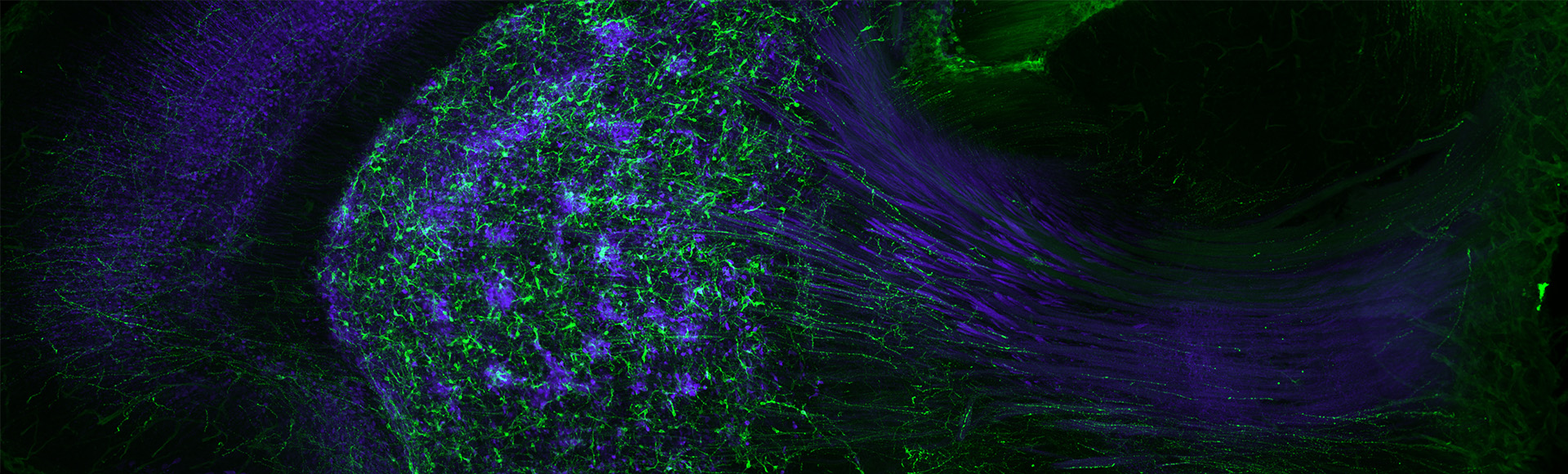 Basal Ganglia Circuitry